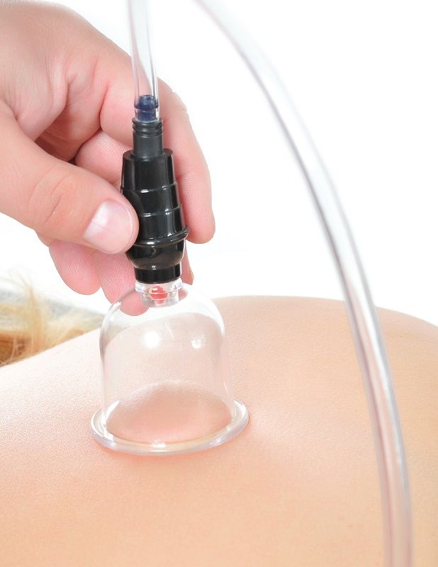 Close-up do FETISH FANTASY SERIES Conjunto de Sucção 6 Peças, mostrando as ventosas e o adaptador.